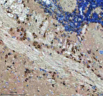 IHC staining of FFPE zebrafish brain tissue with Zebrafish Nova2 antibody. HIER: boil tissue section