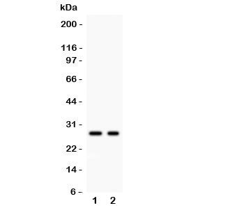 Western blot testing of Kallikrein 4 antibody and Lane 1: 293T; 2: MCF-7 lysate. Predicted size ~27K