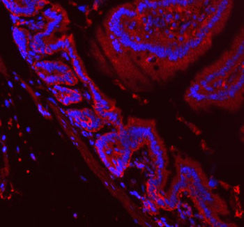 Immunofluorescent staining of APH1A using anti-APH1A antibody (red). APH1A was detected in a paraffi