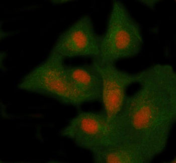 Immunofluorescent staining of NSMCE4A using anti-NSMCE4A antibody (red) and anti-Beta Tubulin antibo