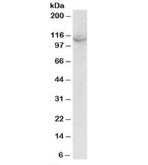 Western blot testing of A431 lysate with OAS3 antibody at 2ug/ml. Predicted molecular weight: ~121kD