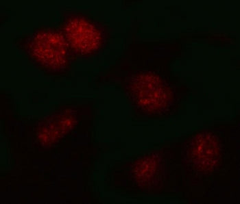 Immunofluorescent staining of FFPE human HeLa cells with PSMB2 antibody (red). HIER: steam section i