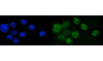 Immunofluorescent staining of FFPE human Caco-2 cells with KLF14 antibody (green) and DAPI nuclear s