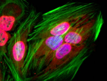 ICC staining of human HeLa cells using recombinant Acetyl Lysine antibody (red). Actin filaments was