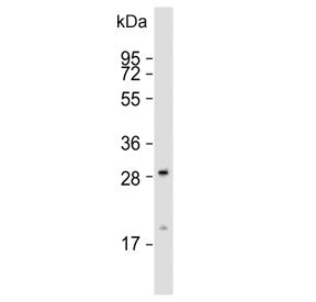 Western blot testing of human HeLa cell lysate with GCLM antibody. Predicted molecular weight ~31 kD