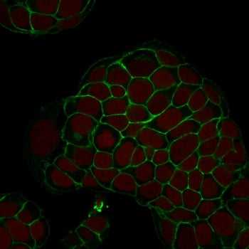 Immunofluorescent staining of human MCF-7 cells with Ep-CAM antibody (green, clone EGP40/1798) and R