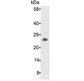 Bcl-2 Antibody