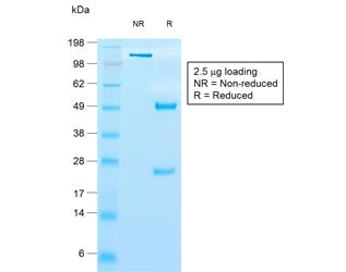 SDS-PAGE analysis of purified, BSA-free recombinant TIMP1 antibody (clone rTIMP1/1710) as confirmati