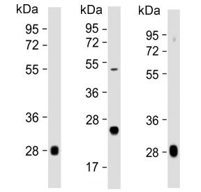 Western blot testing of multiple lots of human plasma lysate with Complement Factor D antibody. Pred