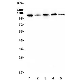 Western blot testing of human 1) U-87 MG, 2) U-2 OS, 3) PC-3, 4) A549 and 5) HepG2 lysate with HIF-1