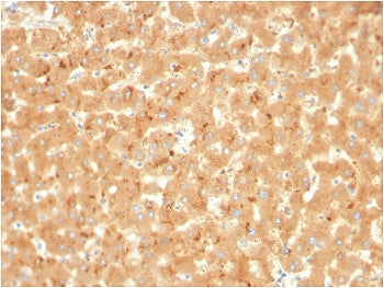 A2M Antibody / Alpha-2-Macroglobulin