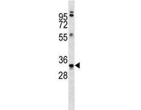Anti-MBP antibody western blot analysis in ZR-75-1 lysate. Multiple isoforms visualized from 20~37 k