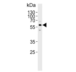 Western blot testing of human SK-BR-3 cell lysate with Cytochrome P450 3A5 antibody. Predicted molec