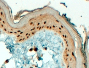 IHC testing of FFPE human skin with TFAP2C antibody at 4ug/ml. HIER: steamed with pH9 Tris/EDTA buff