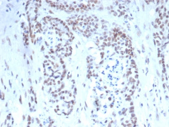IHC staining of FFPE human prostate tissue with TARDBP antibody (clone TARDP/349). HIER: boil tissue