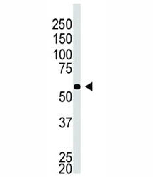 Western blot testing of BACE2C antibody and A549 cell lysate