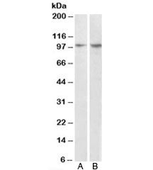 Western blot testing of MCF7 [A] and human breast cancer [B] lysates with P130Cas antibody at 1ug/ml