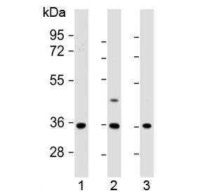 Western blot testing of human 1) U-87 MG, 2) U-2 OS and 3) MDA-MB-231 cell lysate with OR2AE1 antibo