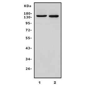 Western blot testing of 1) rat skeletal muscle and 2) mouse skeletal muscle lysate with PARP9 antibo
