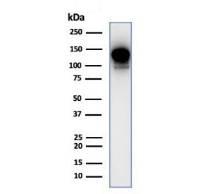 Western blot testing of human THP-1 cell lysate with PIK3CD antibody (clone PIK3CD/4639). Expected m