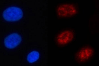 NFRKB Antibody / Nuclear factor related to kappa-B-binding protein