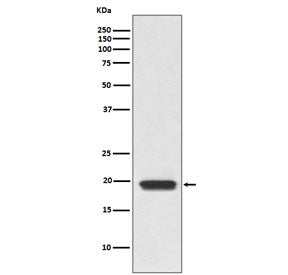 Western blot testing of human Jurkat cell lysate with CD3D antibody. Predicted molecular weight ~19 
