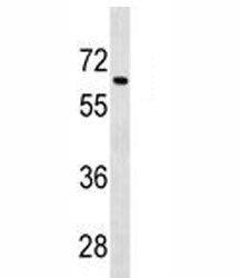 Tgfbr2 antibody western blot analysis in 293 lysate. Expected molecular weight ~65 kDa, routinely ob