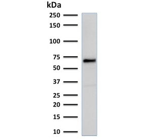 Western blot testing of MCF7 cell lysate with recombinant Estrogen Receptor alpha antibody. Predicte