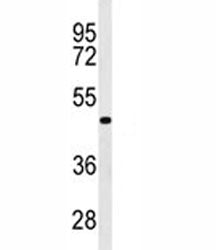 Western blot analysis of GATA6 antibody in WiDr lysate. Predicted molecular weight: 60, 45 kDa (isof