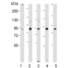 Western blot testing of human 1) HeLa, 2) Jurkat, 3) K562, 4) mouse F9 and 5) mouse testis lysate wi