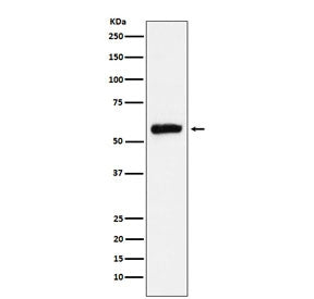 Western blot testing of human HepG2 cell lysate with ALDH2 antibody. Predicted molecular weight ~56 
