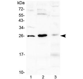 Western blot testing of 1) mouse kidney, 2) mouse spleen and 3) rat skeletal muscle tissue lysate wi
