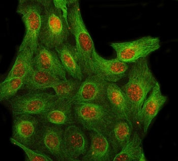 Immunofluorescent staining of FFPE human U-2 OS cells with LRIT3 antibody (red) and Beta Tubulin mAb
