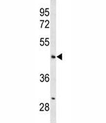 ANGPTL4 Antibody