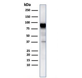 Western blot testing of human MCF7 cell lysate with HSP90AB1 antibody. Expected molecular weight: 84