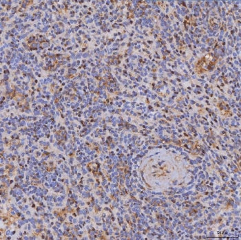 ITK Antibody / IL2-inducible T-cell kinase