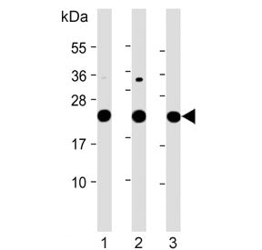 Western blot testing of 1) human HeLa, 2) human K562 and 3) rat PC-12 cell lysate with LZIC antibody