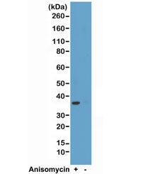 Western blot test of HeLa cell lysate, treated or untreated with anisomycin, using recombinant phosp