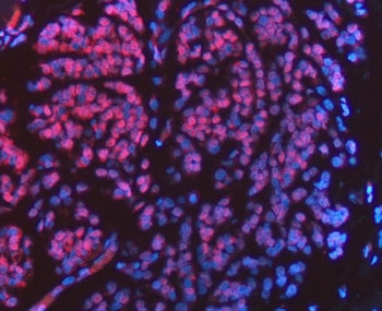 FIP1L1 Antibody / Pre-mRNA 3'-end-processing factor FIP1