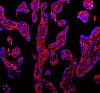 Immunofluorescent staining of FFPE human placental tissue with CD31 antibody (red) and DAPI nuclear 