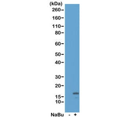 Western blot of acid extracts from HeLa cells untreated (-) or treated (+) with sodium butyrate usin