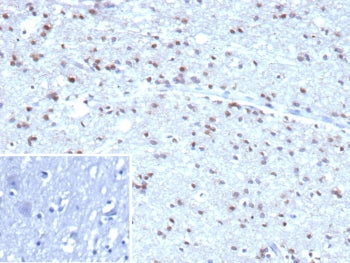 IHC staining of FFPE human brain tissue with recombinant Ubiquitin antibody (clone rUBB/9476). Inset