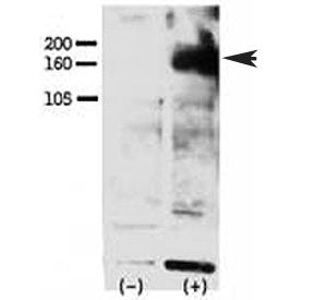 Western blot testing of phospho-ERBB4 antibody and FG pancreatic carcinoma cells treated with or wit