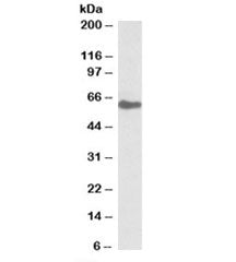 Western blot testing of human kidney lysate with GGT1 antibody at 0.1ug/ml. Predicted molecular weig