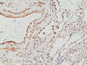 Recombinant MMP12 Antibody