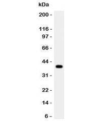 Western blot testing of Cathepsin G antibody and rat thymus lysate. Predicted molecular weight ~29 k