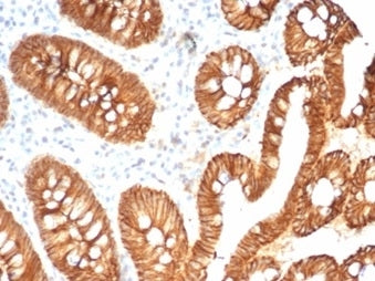 IHC staining of FFPE human colon tissue with recombinant CDH1 antibody (clone CDH1/7034R). HIER: boi
