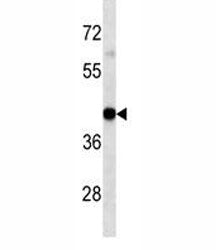 HLA-A Antibody, 0.08ml