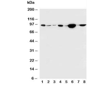 Western blot testing of b-Catenin antibody and Lane 1: rat brain; 2: rat heart; 3: rat testis; 4: hu