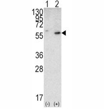 PTEN Antibody